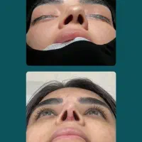 آف جراحی بینی تااخرهفته ۲۸ت دراهواز