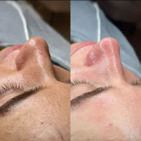 پاکسازی تخصصی و فیشال درمانی تالگو