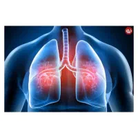 پاکسازی کامل ریه (قلیونی ها و سیگاری ها)