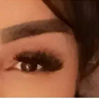 کاشت مژه