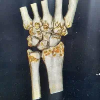 استاد شکسته بندی درنیشابور