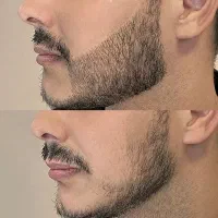 حجم دهی طی بازه زمانی کوتاه