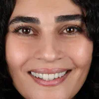 دندانسازی زیبایی علیزاده تخفیف ویژه به مدت محدود
