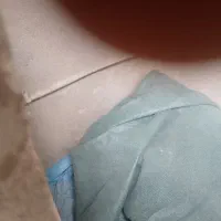 شیلدسایه بان ۸۵درصد