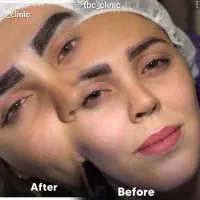 کلینیک تخصصی ،کاشت مو وابرو،نقد واقساط