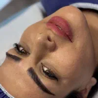 کاشت ابرو دائمی و نچرال / کاشت مو پرتراکم آقایان