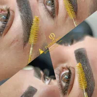 نانوبروزvipو ریموو  و تتو بدن/ نمونه‌کار واقعی