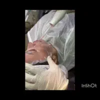 فیشیال و پاکسازی تخصصی پوست