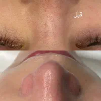 جشنواره تخفیف فیشال با برند لوکس آنوبیس