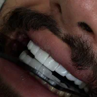 کامپوزیت مونوکروم با قیمت استثنایی هر فک ۵/۹۸۰