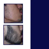 بزرگ شو|آرایشی، بهداشتی، درمانی|سلماس, |دیوار