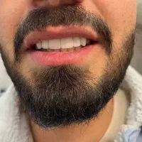 ایمپلنت با پزشک متخصص با طرح وام