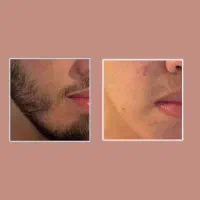 محصولات ریش