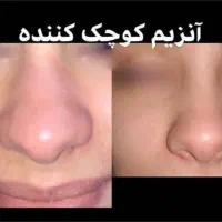 تزریق فیلر ، بوتاکس و پرسینگ و آموزش شیراز، نصر