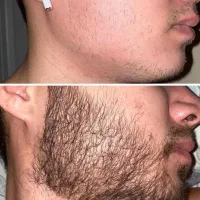 ریشه سبیلو باش