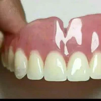 لابراتوار دندانسازی ساخت دندان مصنوعی ضمانتی