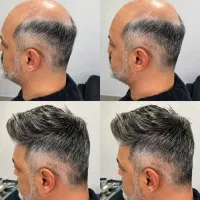 موهاتو با ما تراپی کن