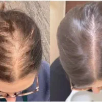 رشدو رویش چند برابری موهات اینجاست