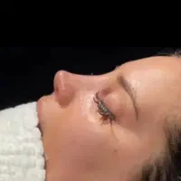 تخفیفات عیدانه با متخصصان گوش حلق بینی