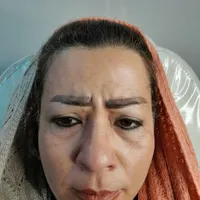 جشنواره تزریق بوتاکس بمناسبت افتتاحیه مطب جدید|خدمات آرایشگری و زیبایی|اصفهان, زاجان|دیوار