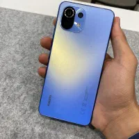 شیاومی mi 11 lite