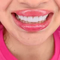 خدمات با کیفیت دندان پزشکی با تعرفه مناسب