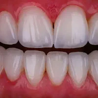 بازاریاب کامپوزیت