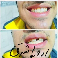 دندانسازی ایرانمنش، تامین اجتماعی، نقد و اقساطی
