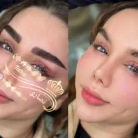 اف میکروبلدینگ،فیبروز،رژلب،تاتو،اسکالپ سر و شقیقه
