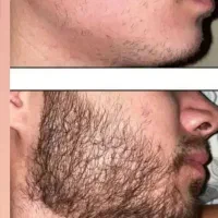 وای این دیگه خدای رویش ریشه