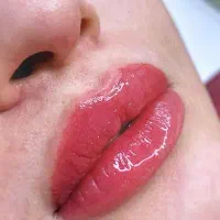ریموو حرفه ای تتو با مواد بایوتیک