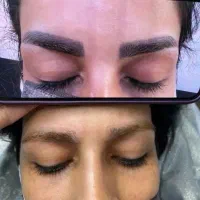 پاک کردن تخصصی تاتو