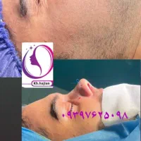 جراحی زیبایی بینی با پزشک فوق متخصص