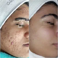 کلینیک پوست و فیشال بانوان و اقایان