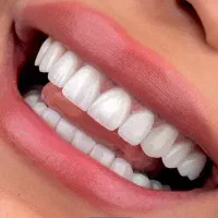 تسهیلات دندانپزشکی بدون پیش پرداخت