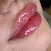 انجام تمام خدمات زیبایی تزریق بوتاکس و فیلر و..