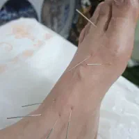 حجامت و سوزن درمانی پاکسازی بدن