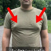 عمل ژنیکوماستی + 100% بدون بازگشت