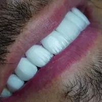 دستیار دندان پزشک( حداقل ۱ سال سابقه)