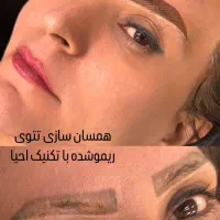 احیای انواع تتوی قدیمی و بدرنگ بدون ریمو