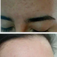 کرم جوانساز بیوممتیک