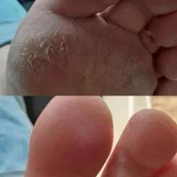 جشنواره کفسابی پا انجام بده مانیکور هدیه بگیر