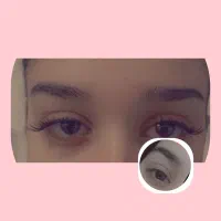 موخوره گیری کوتاهی مو ومژه