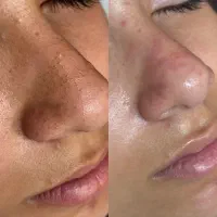 تخفیف ویژه فیشال،لیفت مژه و‌ابرو،رنگ و‌لایت،کراتین