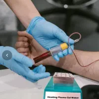 بایوفیلر پلاسما میکرو پی ار پی