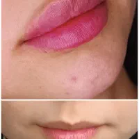 ژل \بوتاکس \لیزر مطب صدف (رویال سابق)