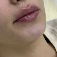 تخفیف ویژه خدمات زیبایی
