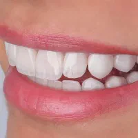 دندانپزشکی با ۵۰ درصد تخفیف