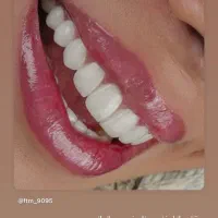 استخدام 2 خانم جهت دستیار دندانپزشک