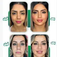 اهداچربی هام رایگان به افراد لاغر